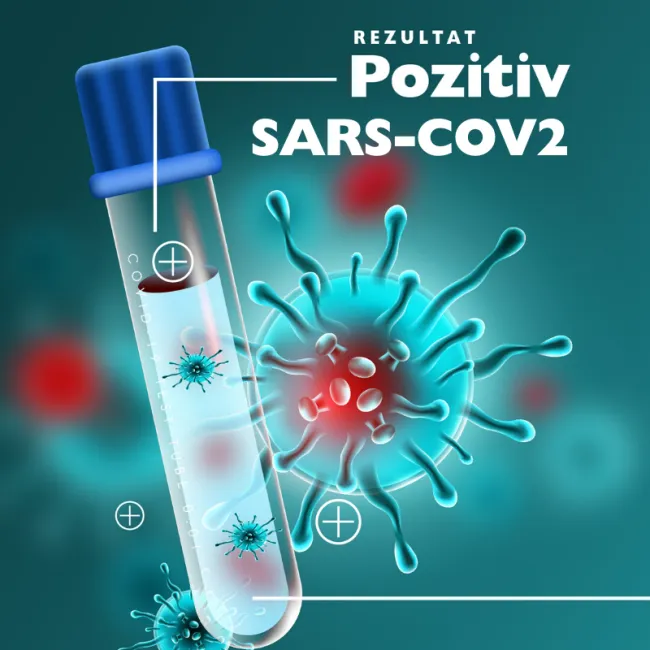 Informații utile despre “ARN Viral SARS-CoV-2”