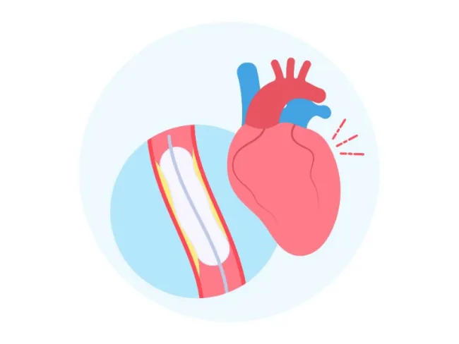 Sindromul antifosfolipidic obstetrical: impactul tehnologiei NGS în diagnosticul precoce
