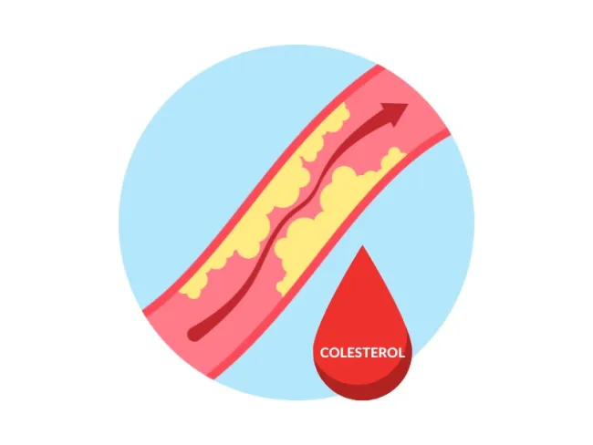 Informații utile despre “Colesterol LDL”