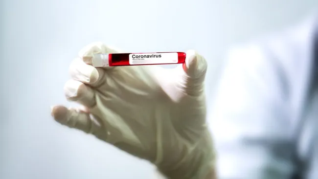 Informații utile despre “ARN Viral SARS-CoV-2”