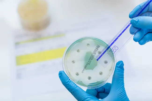 Synevo România deschide primul punct de recoltare în Drobeta-Turnu Severin