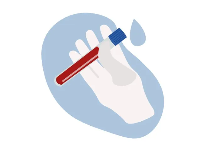 Informații utile despre “Profil lipidic”